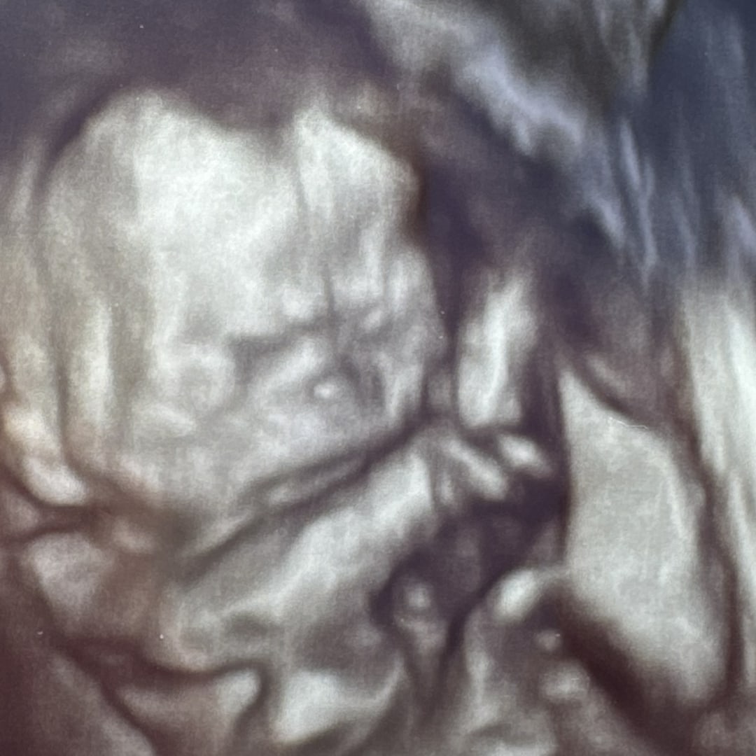 Photo shared by Kayla for their Babylist baby registry.