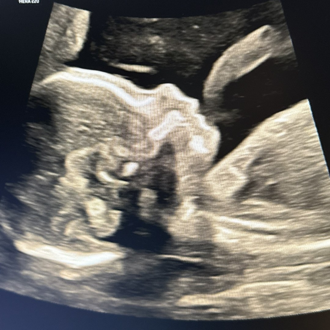 Photo shared by Cindy for their Babylist baby registry.
