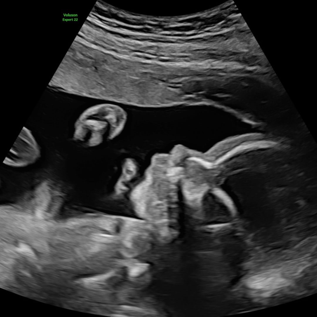 Photo shared by Jenna for their Babylist baby registry.