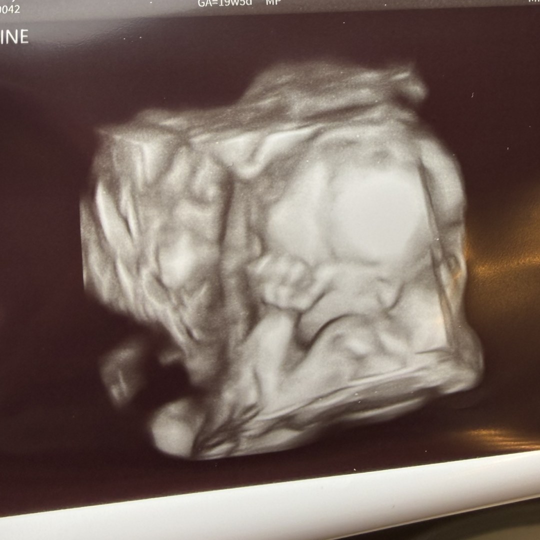 Photo shared by Christina for their Babylist baby registry.