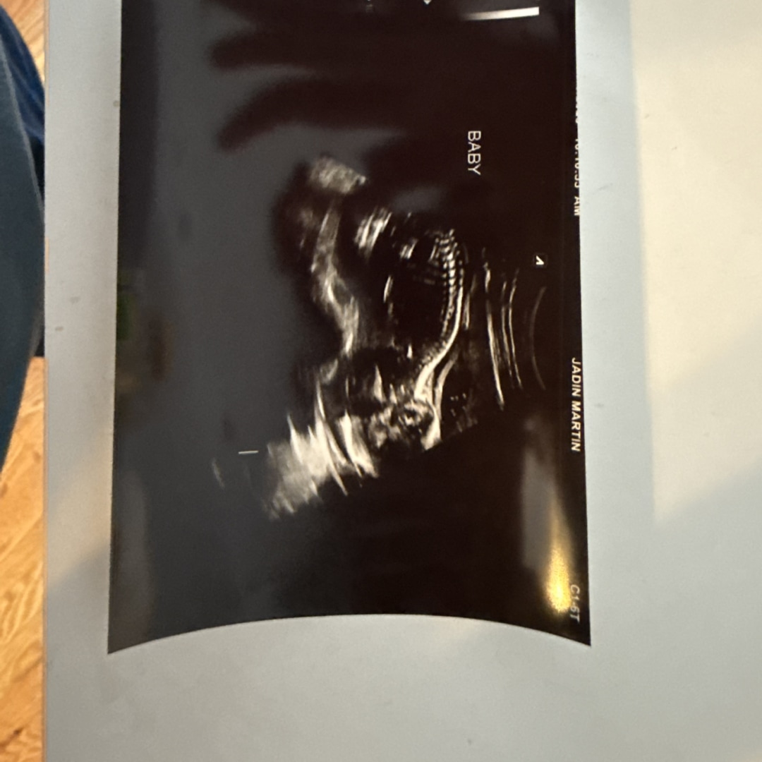 Photo shared by Jadin for their Babylist baby registry.