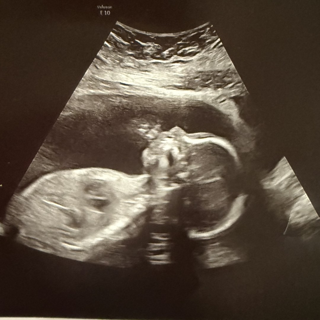 Photo shared by Melissa for their Babylist baby registry.