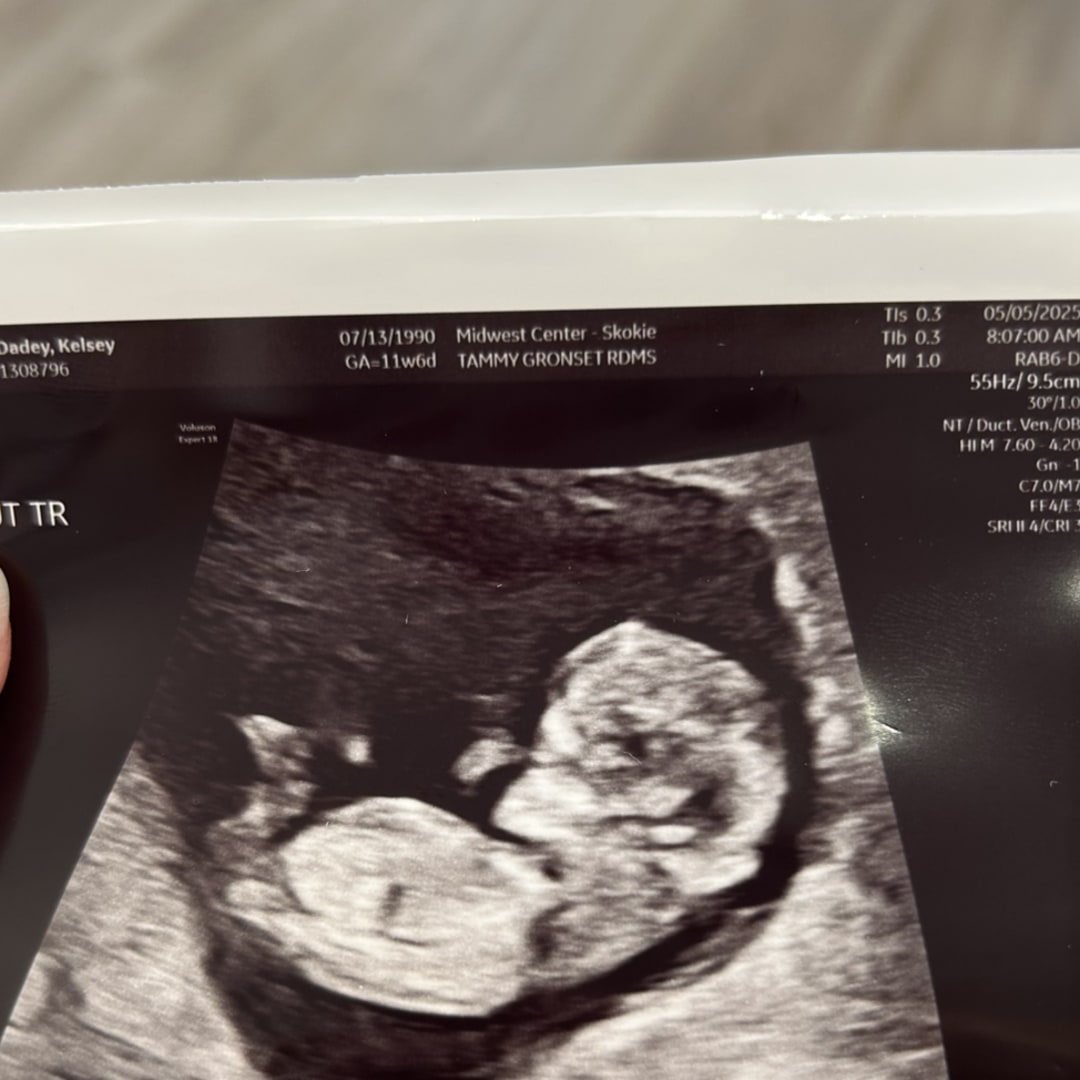 Photo shared by Kelsey for their Babylist baby registry.