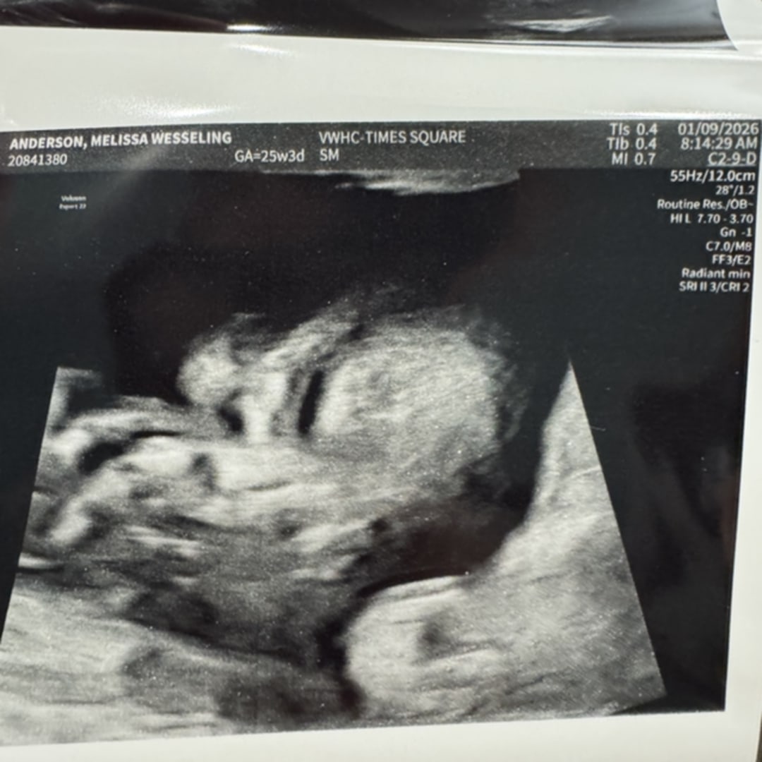 Photo shared by Melissa for their Babylist baby registry.