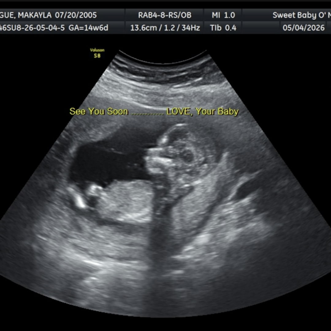 Photo shared by Makayla for their Babylist baby registry.