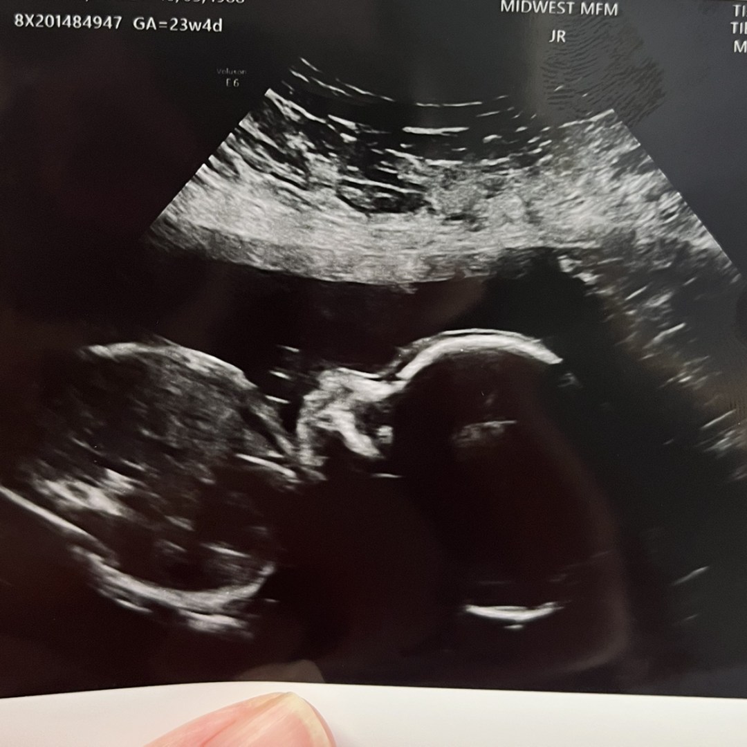 Photo shared by Haley for their Babylist baby registry.