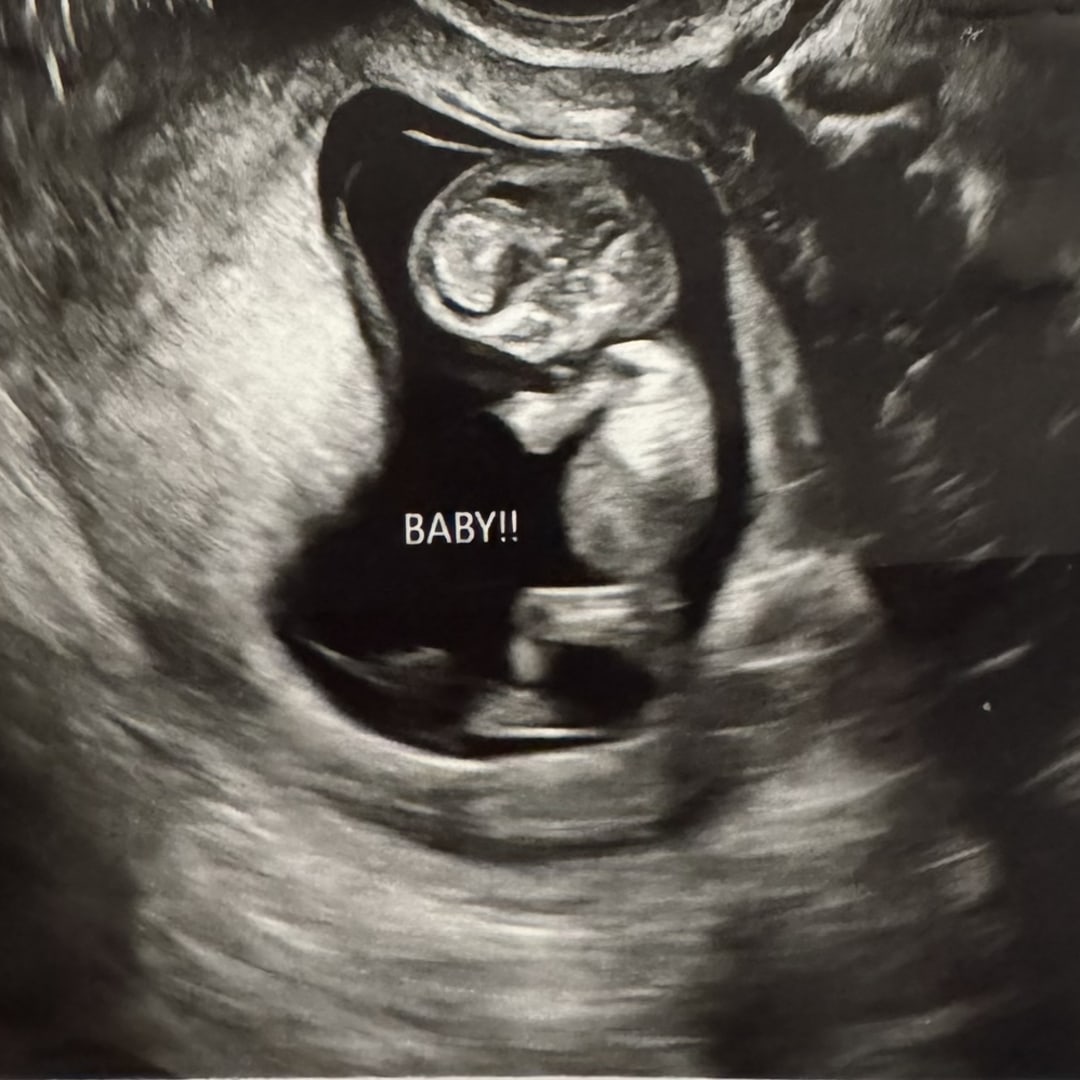 Photo shared by Daniela Joy for their Babylist baby registry.