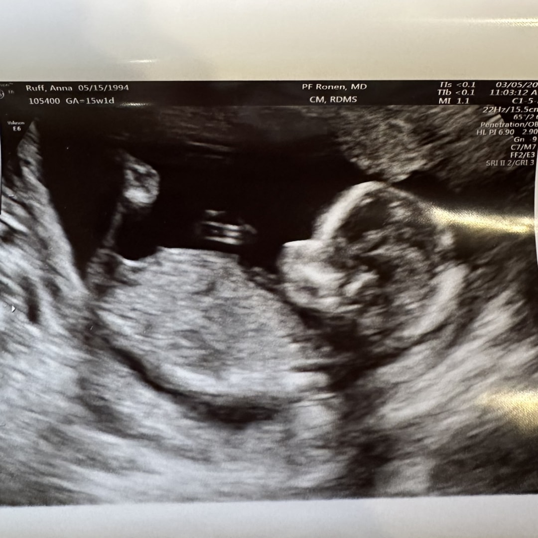 Photo shared by Anna for their Babylist baby registry.