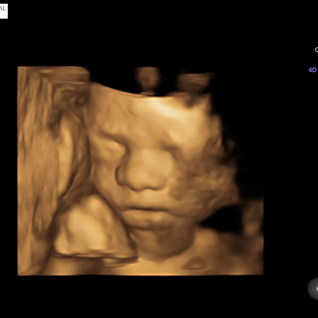 Photo shared by Selena for their Babylist baby registry.