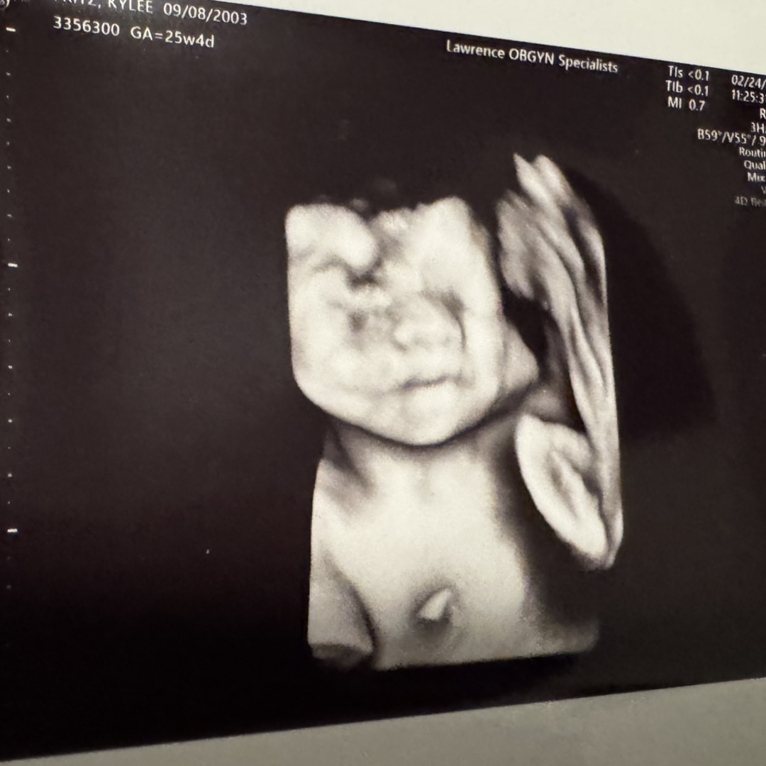 Photo shared by Kylee for their Babylist baby registry.