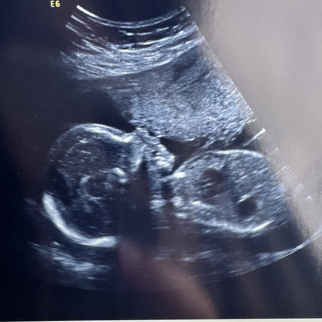 Photo shared by Emma for their Babylist baby registry.