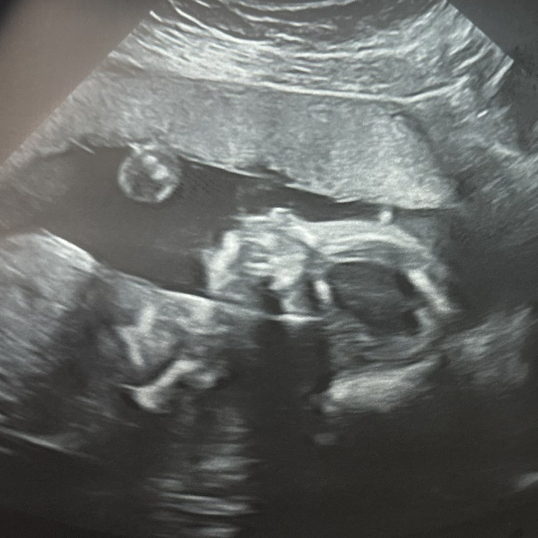 Photo shared by Claudia for their Babylist baby registry.