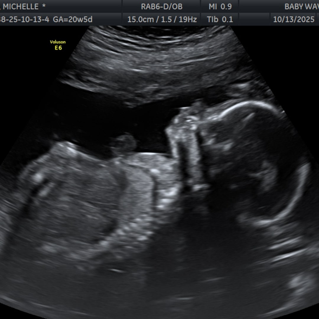 Photo shared by Michelle for their Babylist baby registry.