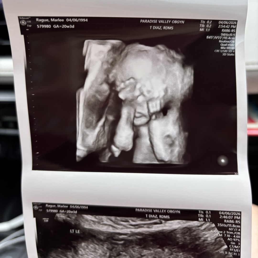 Photo shared by Marlee for their Babylist baby registry.