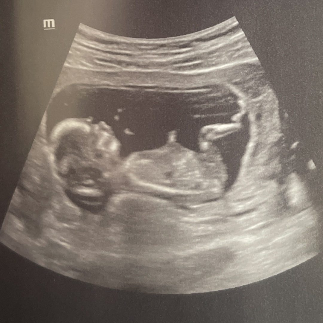 Photo shared by Kay for their Babylist baby registry.