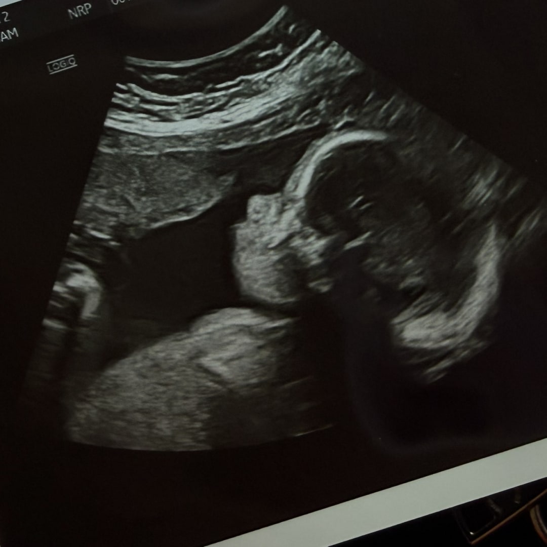 Photo shared by Gracie for their Babylist baby registry.
