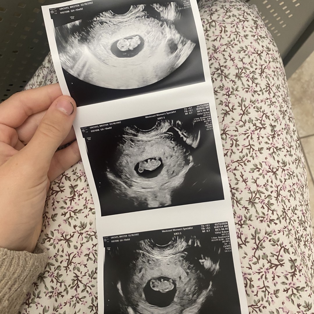 Photo shared by Bristen for their Babylist baby registry.