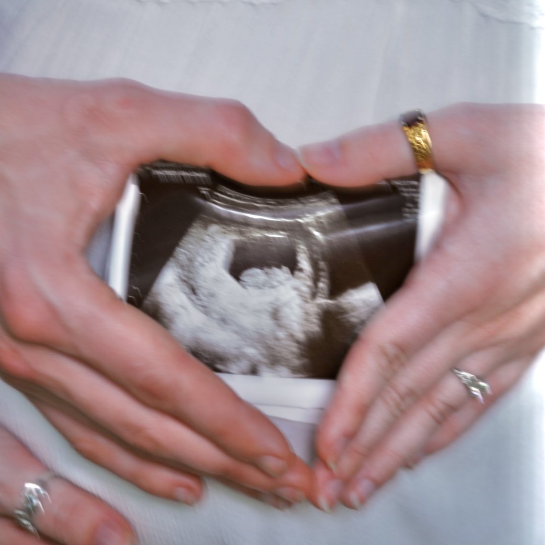 Photo shared by Chloe for their Babylist baby registry.