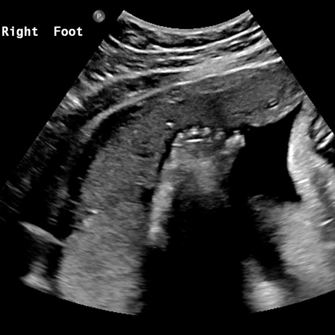 Photo shared by Paulina for their Babylist baby registry.
