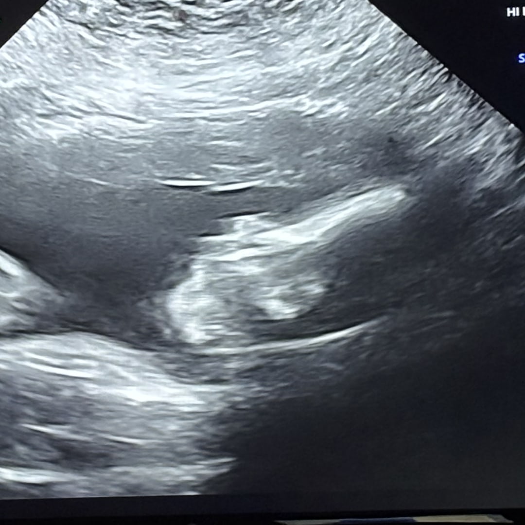 Photo shared by Lauren for their Babylist baby registry.