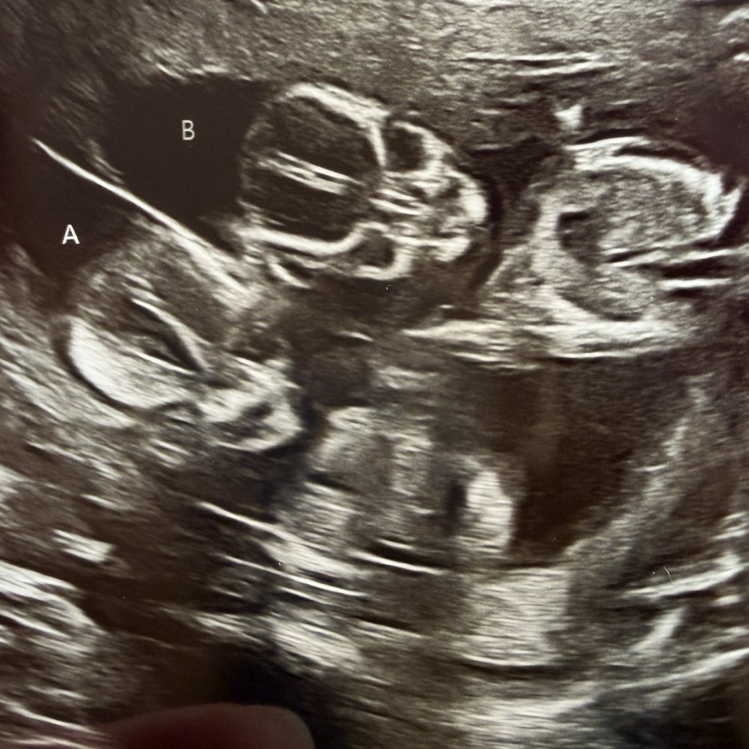 Photo shared by Morgan for their Babylist baby registry.