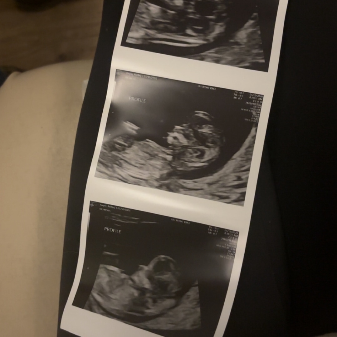 Photo shared by Reilley for their Babylist baby registry.