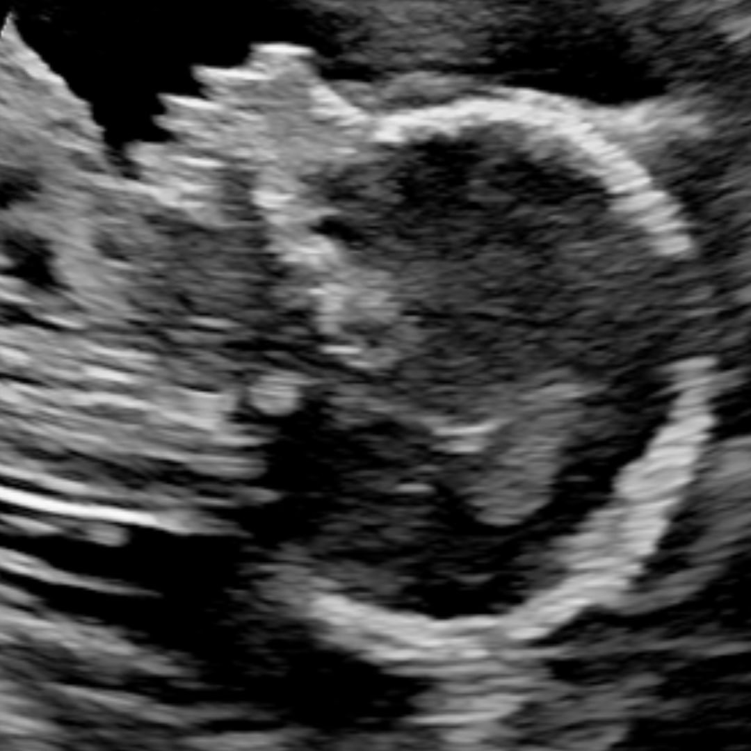 Photo shared by Emma for their Babylist baby registry.