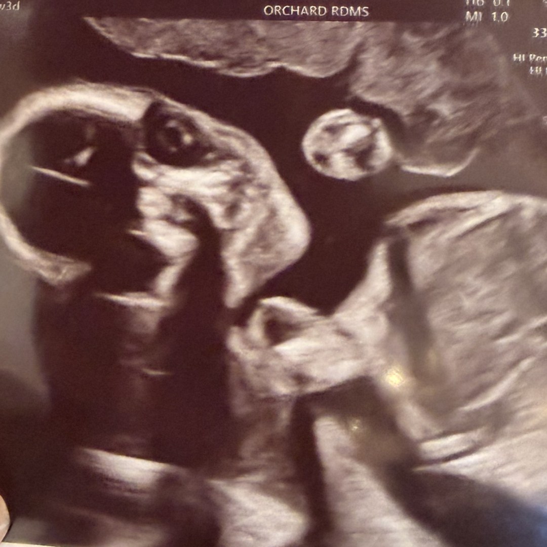 Photo shared by Giselle for their Babylist baby registry.