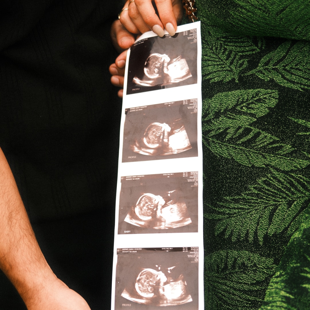 Photo shared by Sarah for their Babylist baby registry.