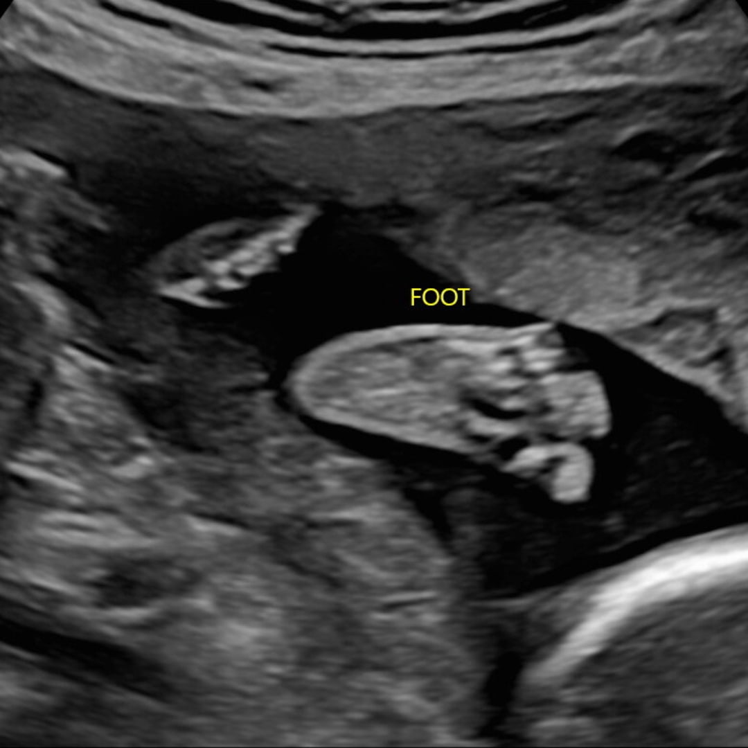 Photo shared by JaCey for their Babylist baby registry.