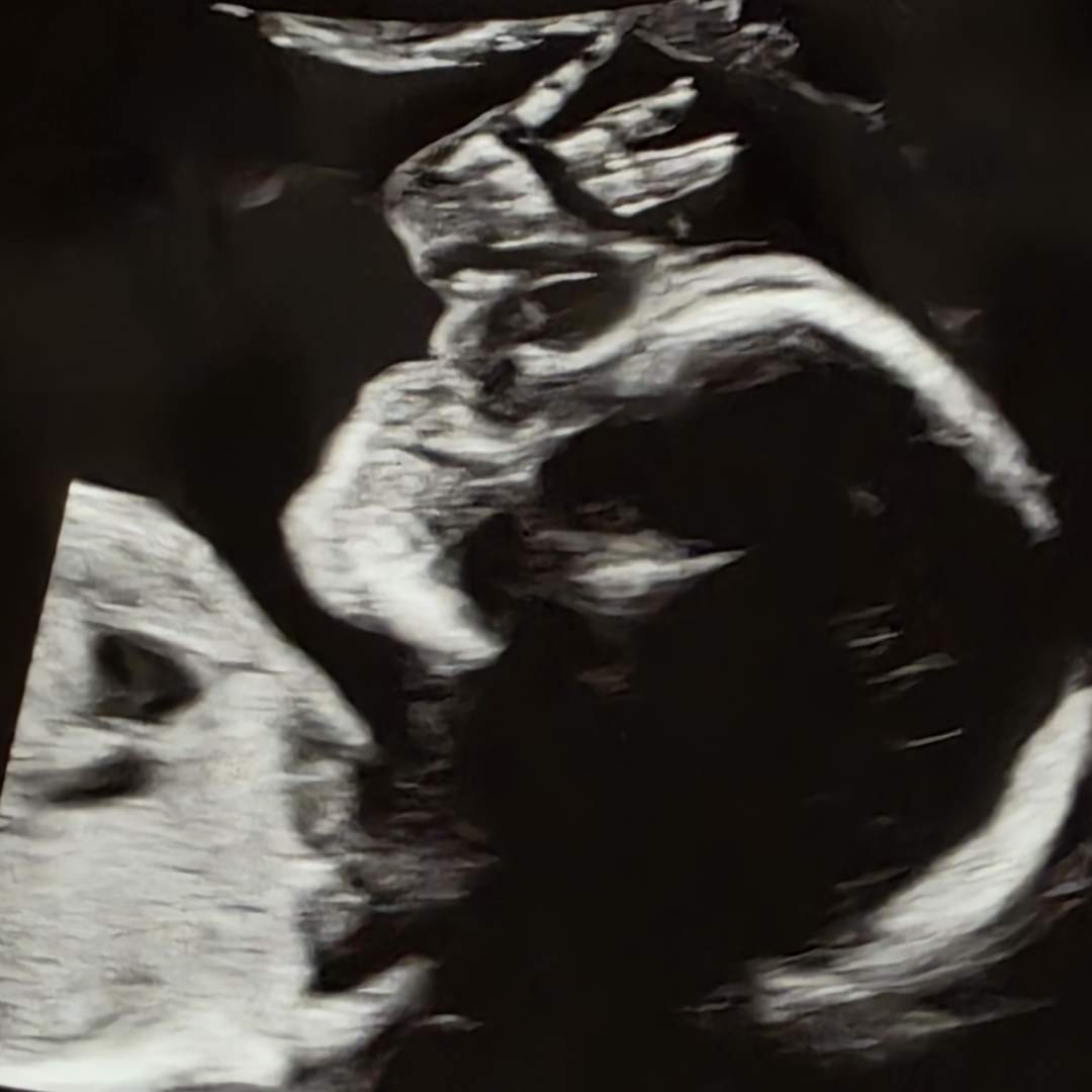 Photo shared by Kendra for their Babylist baby registry.