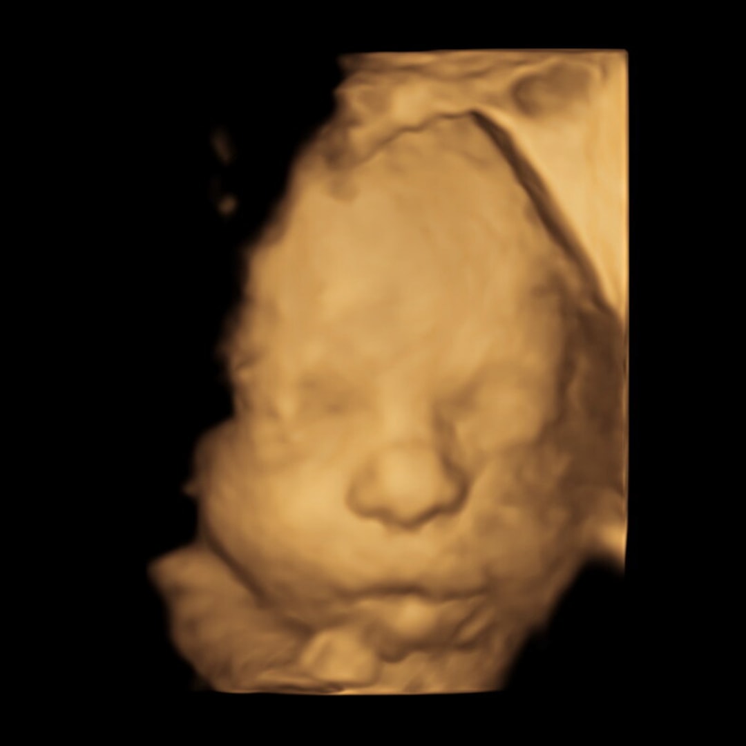 Photo shared by Lisse for their Babylist baby registry.