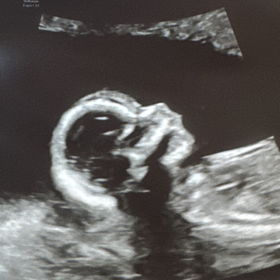 Photo shared by Kendra for their Babylist baby registry.