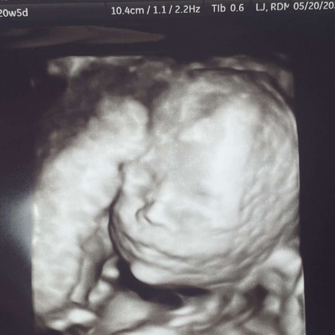 Photo shared by Cherie for their Babylist baby registry.
