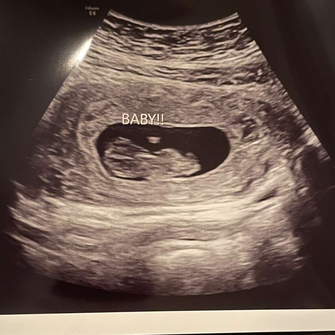Photo shared by Joleena for their Babylist baby registry.