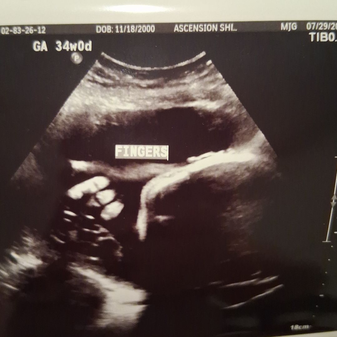 Photo shared by Angel for their Babylist baby registry.