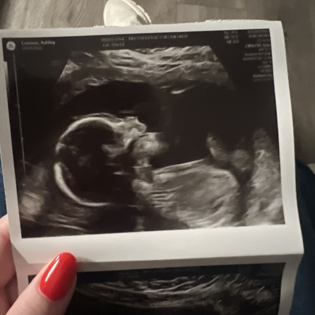 Photo shared by Ashley for their Babylist baby registry.