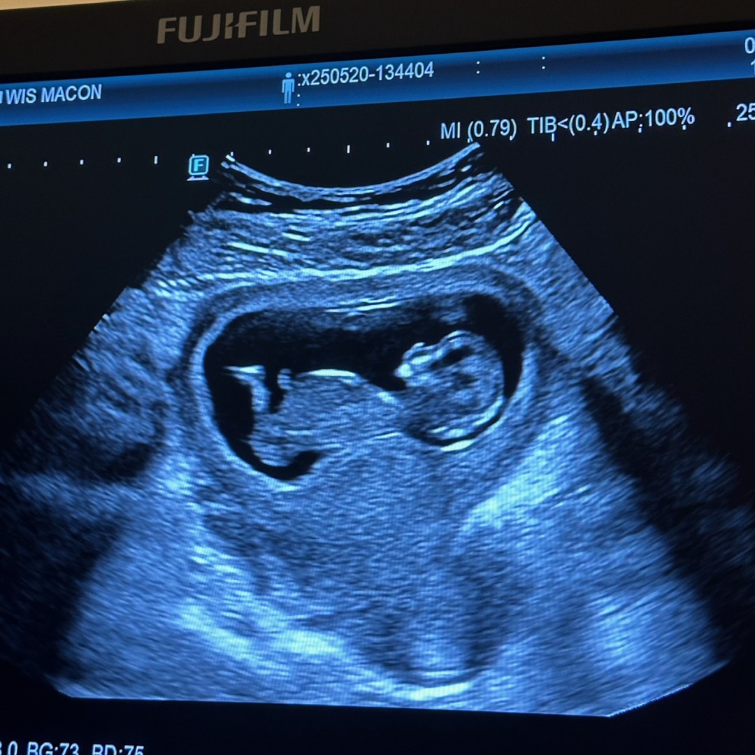 Photo shared by Parker for their Babylist baby registry.