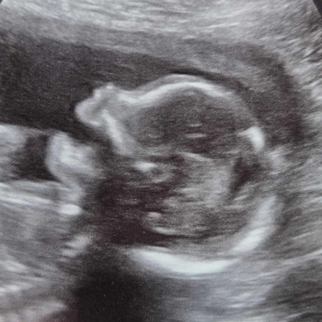 Photo shared by Samantha for their Babylist baby registry.