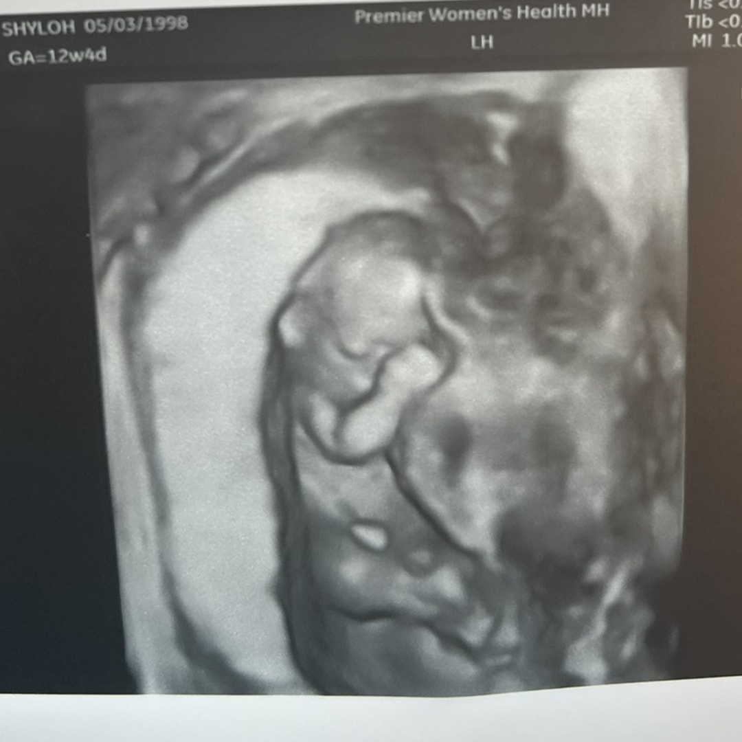 Photo shared by Shyloh for their Babylist baby registry.