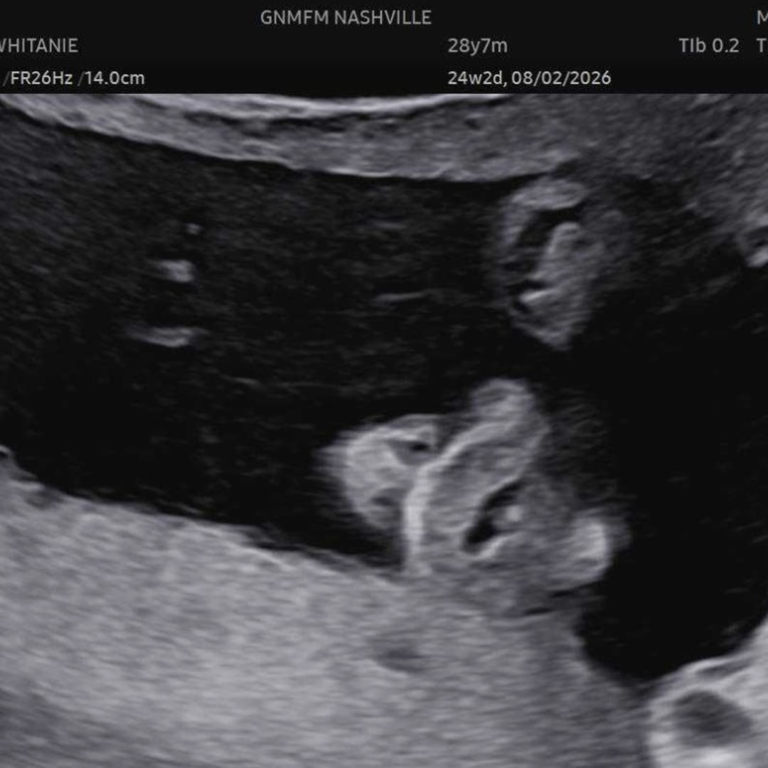 Photo shared by Whitanie for their Babylist baby registry.