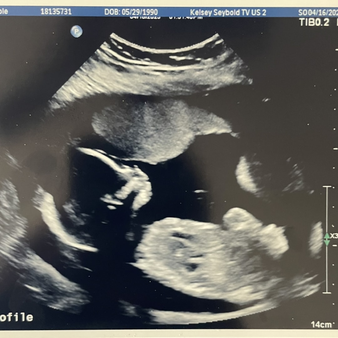 Photo shared by Nicole for their Babylist baby registry.