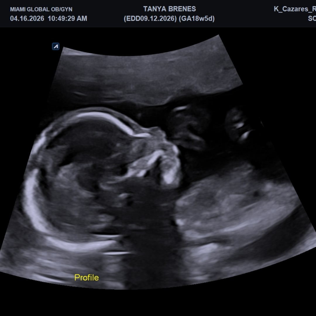 Photo shared by Tanya for their Babylist baby registry.