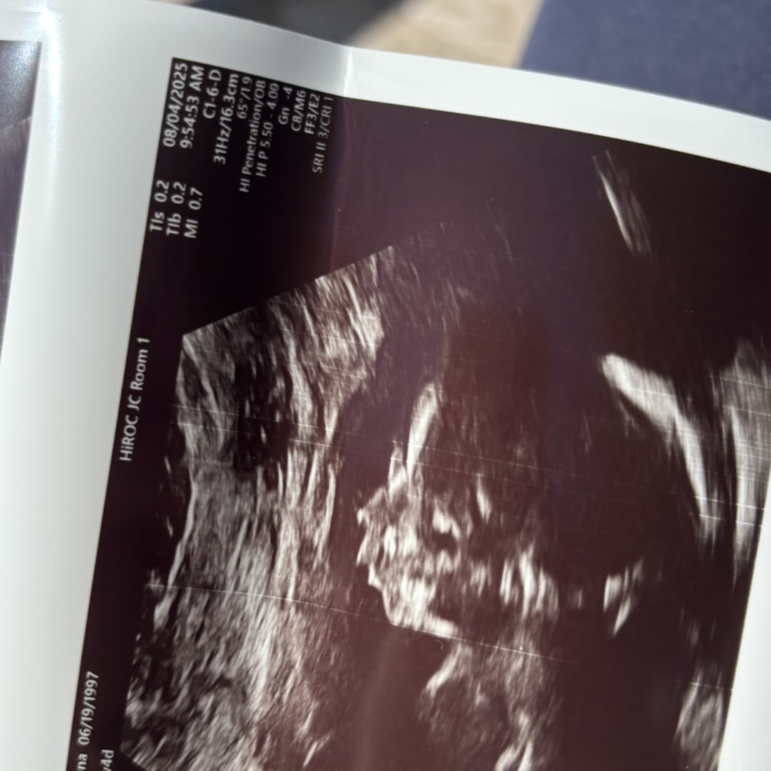 Photo shared by Brea for their Babylist baby registry.