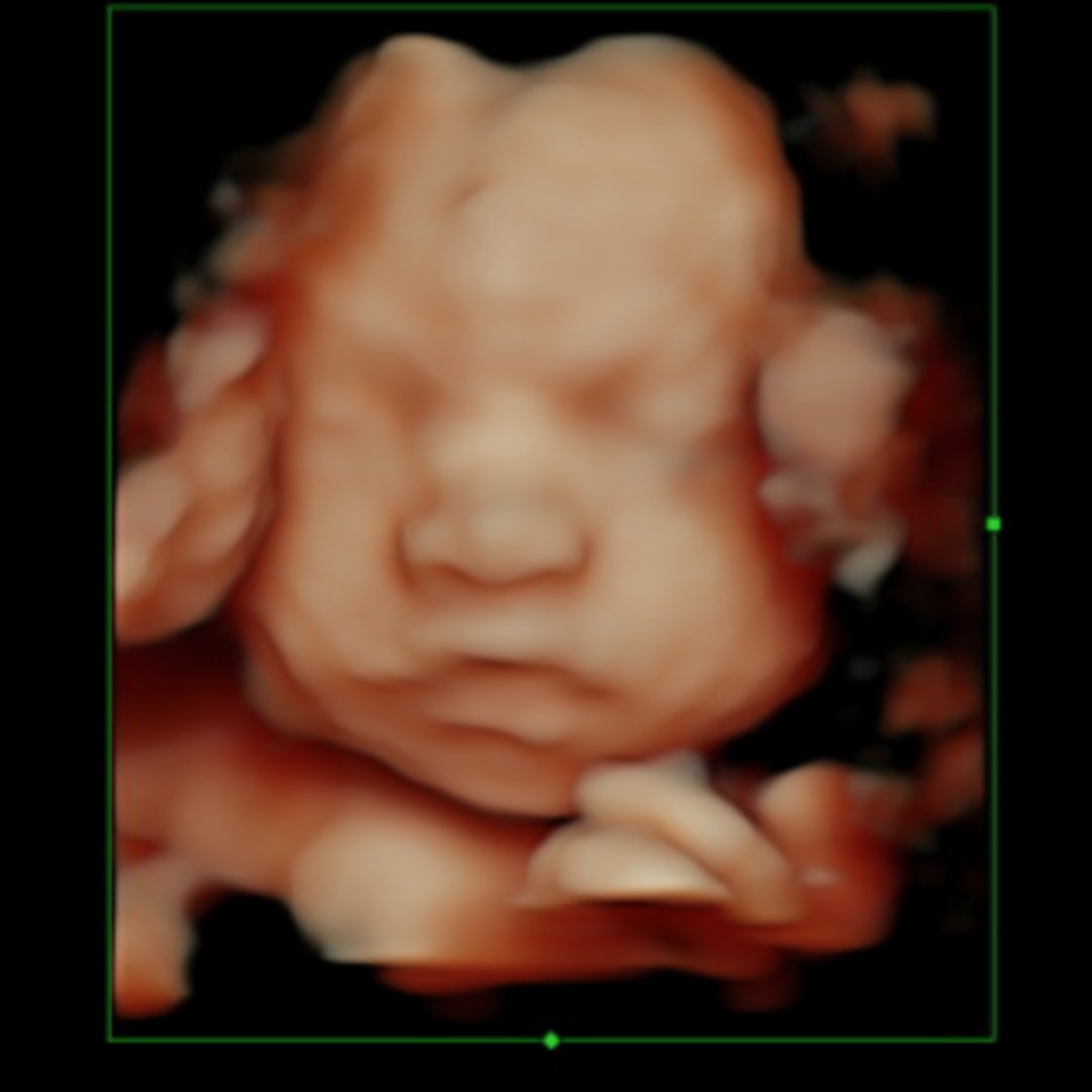 Photo shared by Dru for their Babylist baby registry.