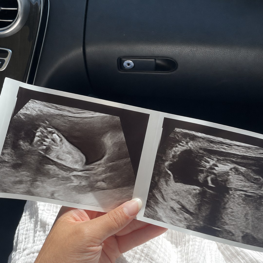Photo shared by Brendalys for their Babylist baby registry.