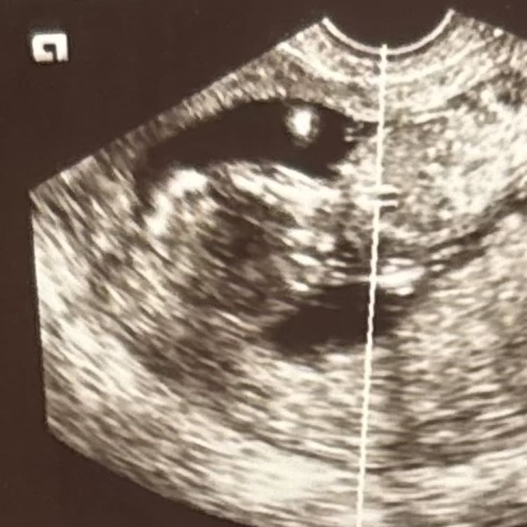 Photo shared by Melissa for their Babylist baby registry.