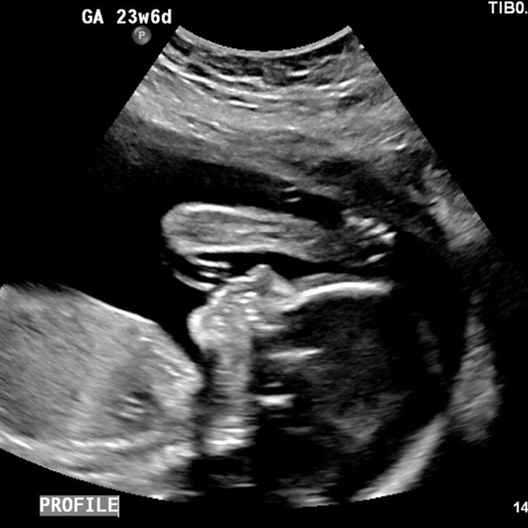 Photo shared by Aubrey for their Babylist baby registry.