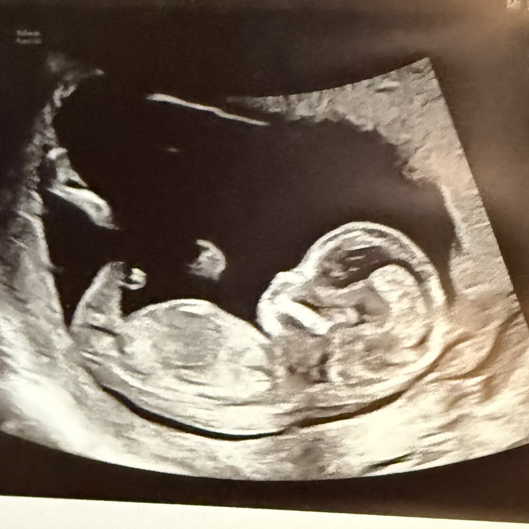 Photo shared by Jenae for their Babylist baby registry.