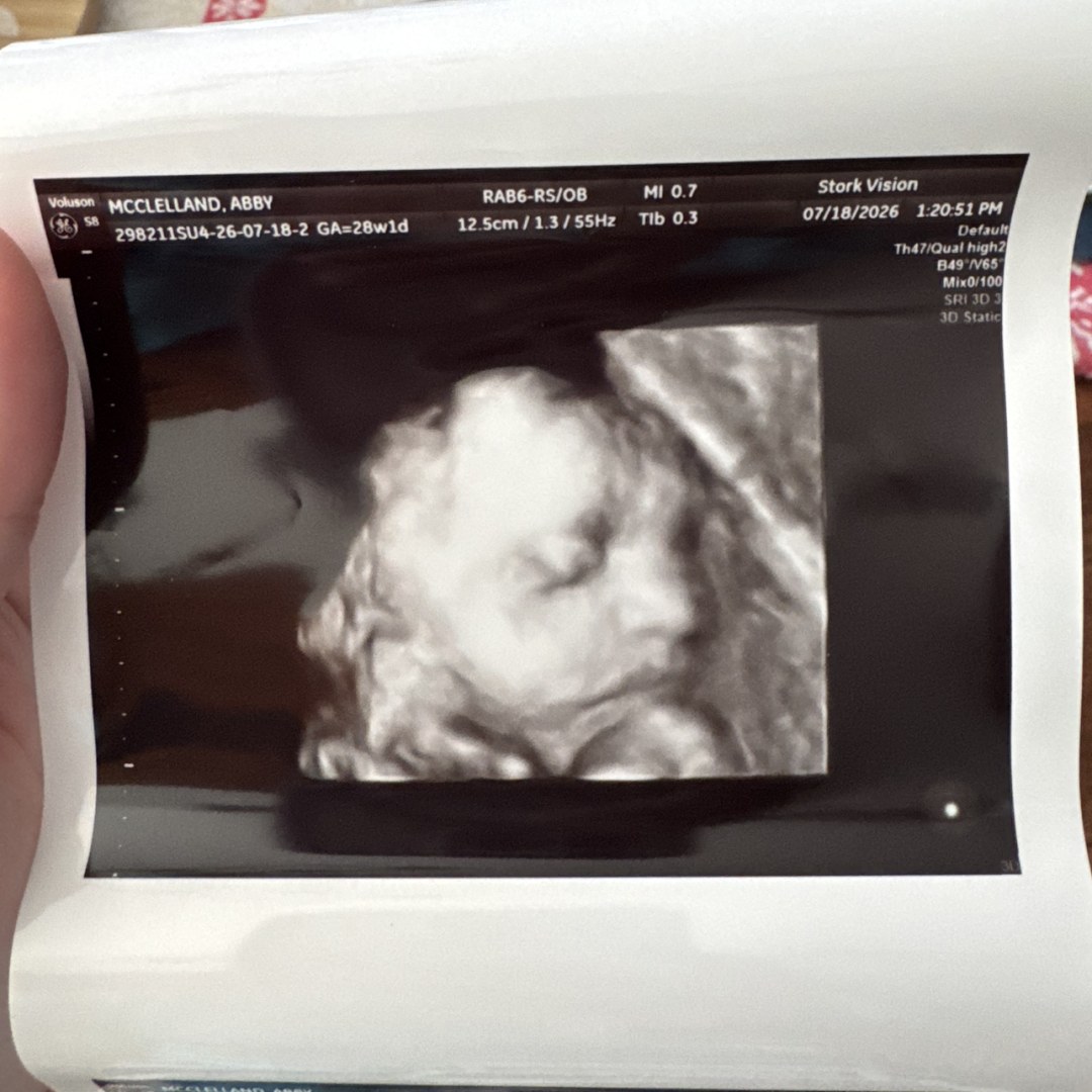 Photo shared by Abby for their Babylist baby registry.